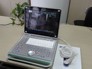 3D Digital Laptop Portable Ultrasound Scanner With Micro - Convex Probe