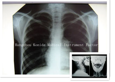 Digital Medical X Ray Dry Film 14 x 17in Health Imaging Radiographic Film